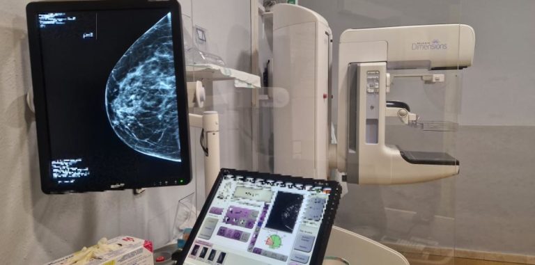 Cerca de 57.000 mujeres han participado en el cribado de cáncer de mama en Aragón este año